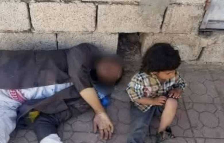 وفاة يمني جائع تفضح مزاعم الحوثيين عن توزيع أموال الزكاة