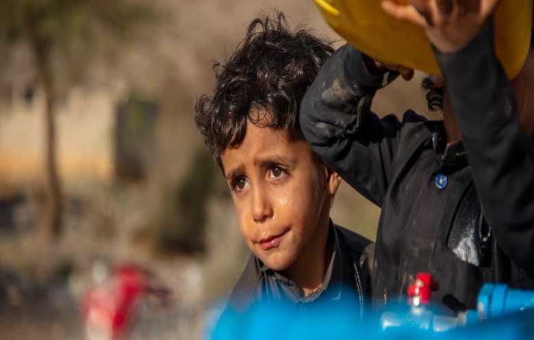 قيود جماعة الحوثي تفاقم سوء تغذية الأطفال في مناطق سيطرتها 