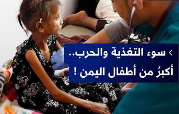 الفقر وسوء التغذية يفاقمان معاناة الأطفال اليمنيين خلال سنوات النزاع الدموي