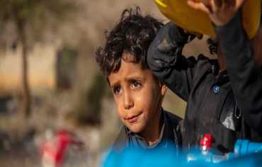 قيود جماعة الحوثي تفاقم سوء تغذية الأطفال في مناطق سيطرتها 